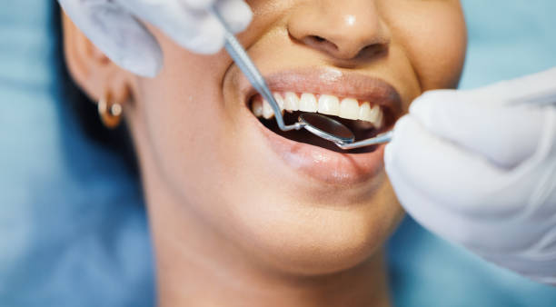 Best Dentist for Tooth Abscess  in Hayfield, VA